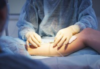 Traitement au laser pour les varices EVLT, ablation endoveineuse, 980 nm 1470 nm, 45W/30W, mini-invasif, fabricant CE MDR