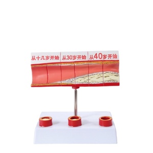 Model perubahan ologis vaskular untuk semua tahap usianya-akurat secara anatomis untuk demonstrasi pendidikan medis & penyakit - Product Image 1