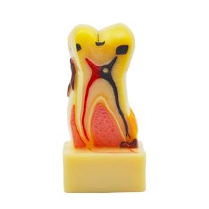 Gelsonlab HSDT-C17 4 Vezes a doença periodontal Modelo Dos Dentes - Product Image 1