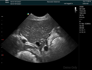 작은 동물을위한 전문 고속 스캔 수의학 컬러 도플러 초음파 선형 배열 선형 초음파 - Product Image 3