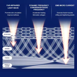 Strumento di pulizia dei pori Anti-Acne per la cura della pelle del viso con onde di collagene portatile per trattamenti personali per gli occhi - Product Image 4
