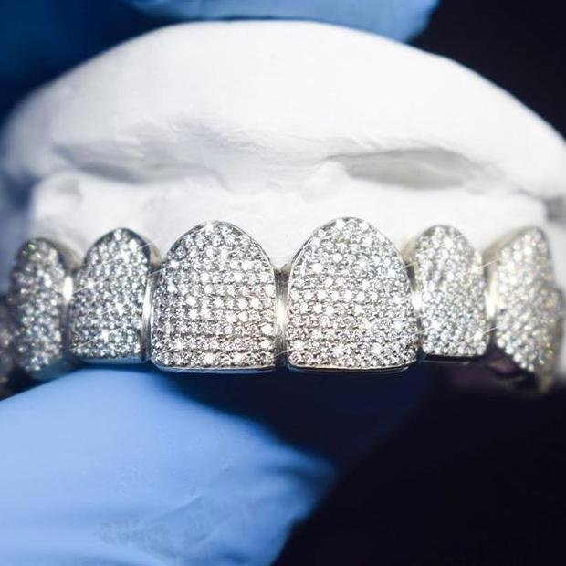 Белое золото 14 карат VVS Муассанит решетки ежедневного ношения льдом хип-хоп ЗУБЫ Grillz босоножки на высоком каблуке Blingbling, алмазной решетки серебристого цвета 925 покрытием