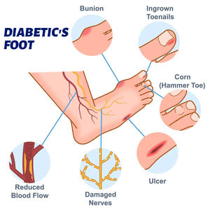 Foot Moisturizer Diabetic Cream for Foot <b>Care</b> Ointment Relieve Private Adults <b>Horse</b> Oil Athlete's Foot Cream - Product Image 4