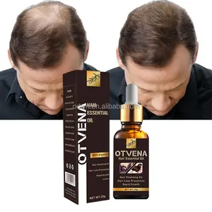 New Product Smoothing Repairing Anti Loss Regrowth Scalp Hair Growth Oil Serum Best Hair Care