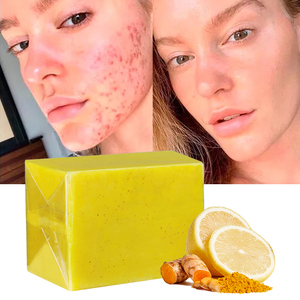 2024 nuovo e più venduto sapone alla curcuma 200g anti acne brufoli macchie scure sbiancamento della pelle zenzero Kojic sapone alla curcuma