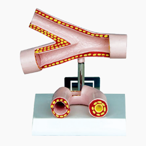 GelsonLab HSBM-231 100X arteria humano modelo <span class=keywords><strong>ganglios</strong></span> <span class=keywords><strong>linfáticos</strong></span> modelo - Product Image 2