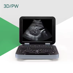 Veterinario portátil Ultrasonido blanco y negro Animal Echo Ganado Equino Ultrasonido Mascota Escáner de ultrasonido veterinario portátil - Product Image 3