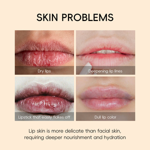 Laikou nutre idrato vitamina C maschera per dormire Private Label Dry Label per la cura della pelle delle <span class=keywords><strong>labbra</strong></span> <span class=keywords><strong>balsamo</strong></span> per le <span class=keywords><strong>labbra</strong></span> - Product Image 5