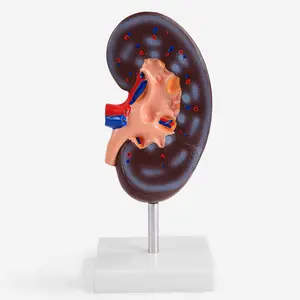 Modelo anatómico de riñón de enseñanza, sistema urinario, anatomía, modelo de riñón humano, modelo anatómico de riñón de plástico humano - Product Image 2