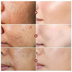 Krim Pengelupas Alga Perawatan Penghilang Flek Hitam, Bintik, Melasma, dan Hiperpigmentasi Wajah - Product Image 3