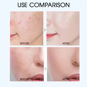 Etiqueta privada Orgánica B3 Colágeno Retinol Niacinamida Suero facial antienvejecimiento Producto para el cuidado de la piel Facial Cuidado DE LA PIEL coreano - Product Image 6