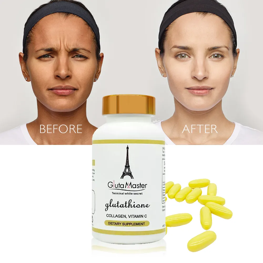 Glutathion anti-âge et anti-rides personnalisé pilules blanchissantes en capsules Comprimés de collagène blanc Gluta Blanchiment de la peau