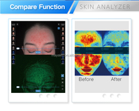 Analizador de Piel Facial Portátil con IA, 5 Espectros, 8MP, WiFi/Bluetooth, Fuente de Luz LED MC88, Control por iPad, Uso Comercial