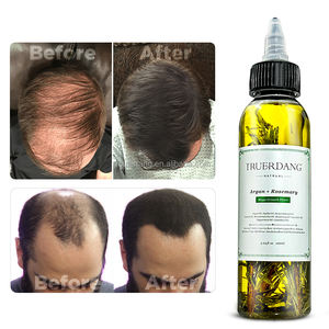 น้ำมันโรสแมรี่บำรุงเส้นผมสูตรออร์แกนิคผสมไบโอตินจากสมุนไพรธรรมชาติ ช่วยเร่งการเจริญเติบโตของเส้นผม ผลิตภัณฑ์สำหรับการเจริญเติบโตของเส้นผม รับผลิตแบรนด์ส่วนตัว - Product Image 3