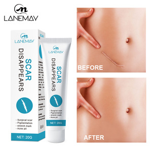 Crème anti-cicatrices d'acné TCM, gel et <span class=keywords><strong>pommade</strong></span> <span class=keywords><strong>pour</strong></span> l'élimination des marques d'acné et des cicatrices, crème réparatrice <span class=keywords><strong>pour</strong></span> <span class=keywords><strong>les</strong></span> brûlures et <span class=keywords><strong>les</strong></span> soins ciblés - Product Image 1