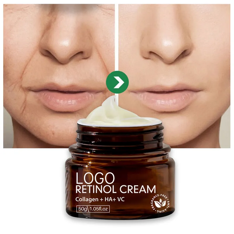 Crema facial antienvejecimiento para el acné, removedor de manchas oscuras, blanqueamiento de la piel negra