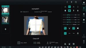 Appareil de radiographie portable <span class=keywords><strong>Rx</strong></span> abordable 14*17/17*17, détecteur numérique à panneau plat pour radiographie, équipement de radiographie - Product Image 6