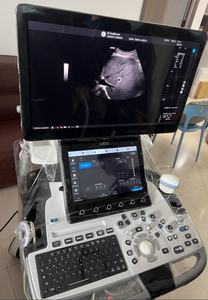 Fourniture et réparation de la machine à ultrasons LOGIQ E11 - Product Image 5