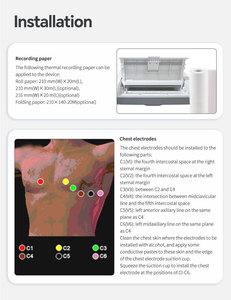 Appareil de <span class=keywords><strong>Cardiotocographie</strong></span> ECG 12 Dérivations CONTEC ECG1212G - Product Image 6