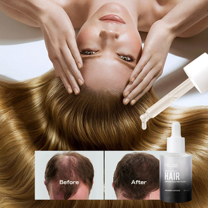 Custom Logo Sensitive Scalp Soothing Promote <b>Hair</b> Growth <b>Serum</b> Caffeine Essential Anti-<b>Hair</b> Loss - Product Image 3