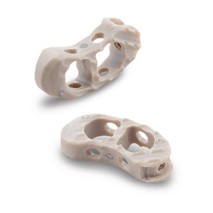 Implantes de fusión lumbar tipo V <span class=keywords><strong>Premier</strong></span> para materiales e accesorios intervencionistas de suministros médicos MOMO - Product Image 2