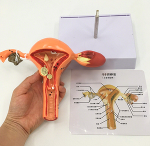 Mannequin de formation en gynécologie modèle d'utérus <span class=keywords><strong>3D</strong></span> réaliste outil d'enseignement anatomiquement précis équipement de formation scolaire en médecine - Product Image 4