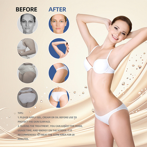 เครื่องฟื้นฟูผิวอเนกประสงค์ 40k สำหรับสลายไขมัน ลดเซลลูไลท์ พร้อมหัวเปลี่ยนหลากหลายสำหรับใช้ในบ้าน - Product Image 3