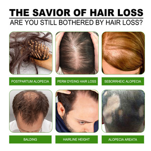 Оптовая продажа, жидкость для подтяжки волос, крепкая и Питательная Жидкость для массажа волос и кожи головы - Product Image 4