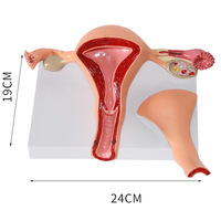 Precio al por mayor, estructura anatómica precisa de los órganos reproductivos internos para uso médico, modelo de útero femenino normal