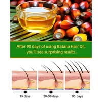 100% Minyak Esensial Perawatan Rambut Herbal Batana & Rosemary Vegan Organik Murni untuk Memperkuat & Menutrisi Rambut Anti-Rontok
