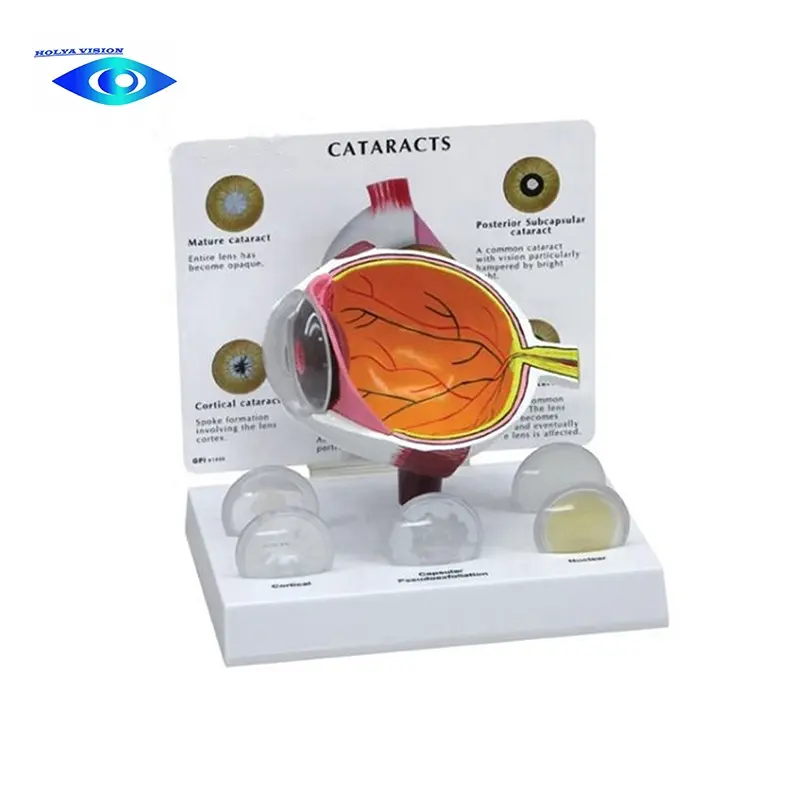 Modelo de ojo humano de catarraco para ciencia médica, modelo de ojo anatómica