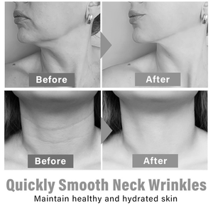 Cổ nâng dưỡng ẩm làm săn chắc điều trị cường độ cao bio-cellulose Mặt Nạ Hàn Quốc chăm sóc da da da thắt chặt các bản vá lỗi cổ mặt nạ - Product Image 4