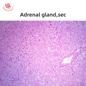 Eierstöcke Medizinische Wissenschaft Hochschul bildung Eierstock Abschnitt <span class=keywords><strong>Human</strong></span> histologie Folien - Product Image 4