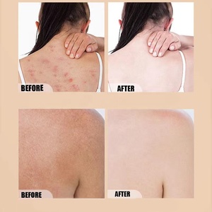 Sapone liquido allo <span class=keywords><strong>zolfo</strong></span> OEM con acido citrico olio di pesca controlarne rimuovere gli acari Caregentle bagnoschiuma sapone liquido Gel doccia - Product Image 2