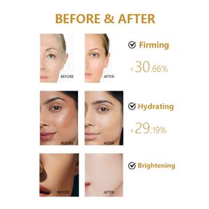 Set de Cuidado Facial con Arroz Natural, Productos para Aclarar la Piel, Suero Antienvejecimiento y Tónico, con Etiquetas Personalizadas - Product Image 2