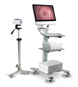 Colposcopio Óptico Digital de Alta Calidad para Imágenes Precisas, Colposcopia, <span class=keywords><strong>Examen</strong></span> Ginecológico - Product Image 3