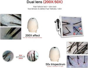 Analyseur de peau numérique professionnel de 15 pouces, caméra pour cuir chevelu, appareil de test pour follicules pileux, huile et humidité - Product Image 5