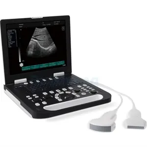 Portable Full Digital Dp10 Ultrasound Scanner LED Clinical Application Ultrasound Machine Ruisheng N50