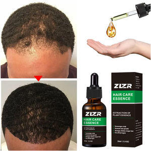 Thérapie Capillaire Bio Rapide 7 Jours à Base de Plantes Naturelles, Huile de Gingembre, Huile d'Arbre à Thé, Huile de Coco, Marque Privée OEM, Anti-Pelliculaire, Rafraîchissante et Nourrissante - Product Image 1