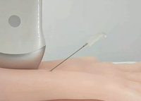 Modelo de estenosis de fístula arteriovenosa guiado por ultrasonido - Membrana de estoma para entrenamiento de dilatación con balón de anastomosis PTA en modo B