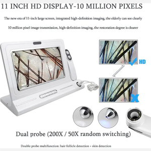 Detector de Análisis Capilar de Cuatro Espectros para Cuero Cabelludo y Piel, Pantalla Grande HD, 200 Aumentos, para Salón de Belleza y Uso Manual en Depilación - Product Image 4