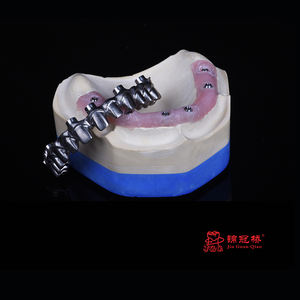 Implant <span class=keywords><strong>dentaire</strong></span> Toutes les couronnes et ponts dentaires <span class=keywords><strong>en</strong></span> céramique avec un <span class=keywords><strong>prix</strong></span> compétitif esthétique élevé - Product Image 6