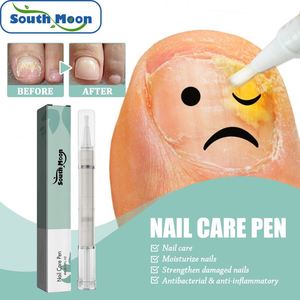 Suero Herbal Antifúngico <span class=keywords><strong>para</strong></span> <span class=keywords><strong>Uñas</strong></span> South Moon, Cuidado <span class=keywords><strong>de</strong></span> <span class=keywords><strong>los</strong></span> Pies, Onicomicosis, Paroniquia, Loción <span class=keywords><strong>para</strong></span> <span class=keywords><strong>Uñas</strong></span>, Blanco <span class=keywords><strong>para</strong></span> <span class=keywords><strong>Hongos</strong></span> en <span class=keywords><strong>las</strong></span> <span class=keywords><strong>Uñas</strong></span> - Product Image 1