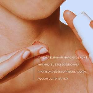 STOP AKNEIK Traitement de l'acné avec de la niacinamide et de l'acide salicylique pour les peaux sujettes à l'acné, tube sans air de 50 ml - Product Image 2