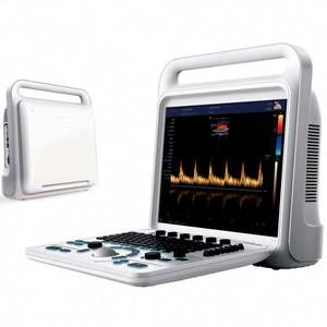 Machine portative de diagnostic ultrasonique de Doppler de couleur pour l'abdomen gynécologie obstétrique cardiaque urologie andrologie petites pièces - Product Image 1