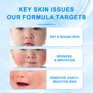 <span class=keywords><strong>Crema</strong></span> idratante infusa al burro di karité delicato olio di Jojoba <span class=keywords><strong>crema</strong></span> idratante per neonati e neonati pelle sensibile <span class=keywords><strong>crema</strong></span> per il viso del bambino - Product Image 3