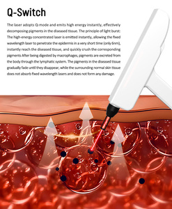 Nuevo Producto: Máquina de Belleza 2 en 1 con Láser Fraccional de CO2 + Láser de Diodo para el Cuidado de la Piel, 10600nm, para Tratamiento de Pecas - Product Image 6