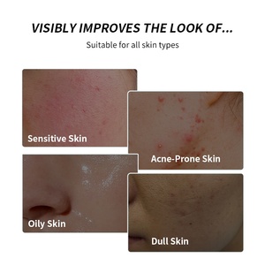 Tónico Facial Coreano <span class=keywords><strong>AHA</strong></span> <span class=keywords><strong>BHA</strong></span> PHA con Niacinamida, Ácido Salicílico y Árbol de Té, Exfoliante e Iluminador, 150 ml - Product Image 5