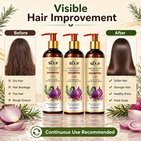 Champú SILU de Marca Privada con Romero y Cebolla para el Crecimiento del Cabello, Champú con Aminoácidos Contra la Caída del Cabello