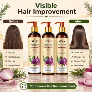 Champú SILU de Marca Privada con Romero y Cebolla para <span class=keywords><strong>el</strong></span> Crecimiento del Cabello, Champú con Aminoácidos Contra la Caída del Cabello - Product Image 5